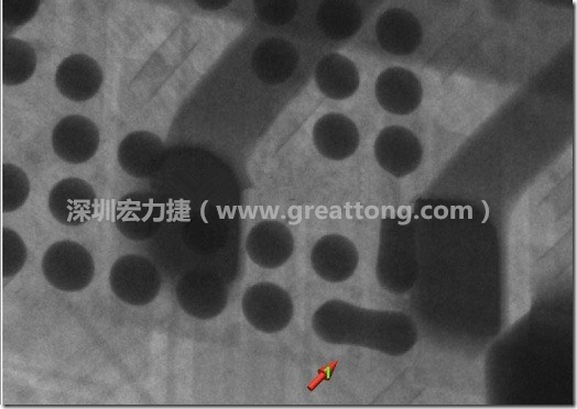 BGA因?yàn)楹笁|變小，造成錫膏過多而最終形成焊接短路的結(jié)果。